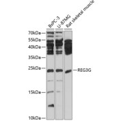 Western blot analysis of extracts of various cell lines, using REG3G antibody (abx001758) at 1/1000 dilution.