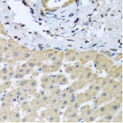 Immunohistochemistry of paraffin-embedded human liver injury using LETMD1 antibody (abx001759) at dilution of 1/100 (40x lens).