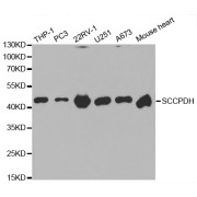 Western blot analysis of extracts of various cell lines, using SCCPDH antibody (abx001760) at 1/1000 dilution.