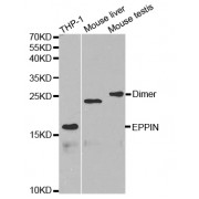 Western blot analysis of extracts of various cell lines, using EPPIN antibody (abx001761) at 1/1000 dilution.