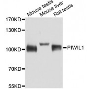 Western blot analysis of extracts of various cell lines, using PIWIL1 antibody (abx001762) at 1/1000 dilution.