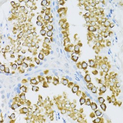 Piwi-Like Protein 1 (MIWI) Antibody