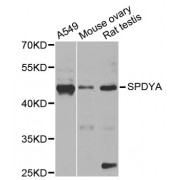 Western blot analysis of extracts of various cell lines, using SPDYA antibody (abx001765) at 1/1000 dilution.