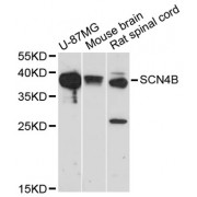 Western blot analysis of extracts of various cell lines, using SCN4B antibody (abx001766) at 1/1000 dilution.