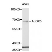 Western blot analysis of extracts of A-549 cells, using ALOX5 antibody (abx001770) at 1/1000 dilution.