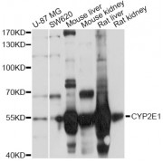 Western blot analysis of extracts of various cell lines, using CYP2E1 Antibody (abx001772) at 1/1000 dilution.