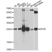 Western blot analysis of extracts of various cell lines, using EIF4E antibody (abx001774) at 1/1000 dilution.