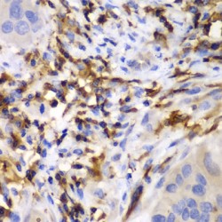 Hematopoietic Lineage Cell-Specific Protein (HCLS1) Antibody
