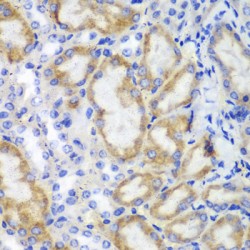 Hematopoietic Lineage Cell-Specific Protein (HCLS1) Antibody