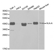 Western blot analysis of extracts of various cell lines, using HLA-A antibody (abx001779) at 1/1000 dilution.