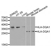 Western blot analysis of extracts of various cell lines, using HLA-DQA1 antibody (abx001780) at 1/1000 dilution.