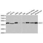 Western blot analysis of extracts of various cell lines, using IDH1 antibody (abx001781) at 1/1000 dilution.