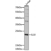 Western blot analysis of extracts of Jurkat cells, using IL10 antibody (abx001783) at 1/1000 dilution.