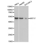Western blot analysis of extracts of various cell lines, using KRT17 antibody (abx001787) at 1/1000 dilution.