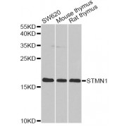 Western blot analysis of extracts of various cell lines, using STMN1 antibody (abx001788) at 1/1000 dilution.