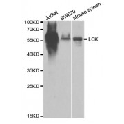Western blot analysis of extracts of various cell lines, using LCK antibody (abx001789) at 1/1000 dilution.