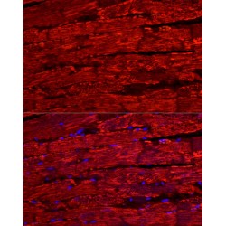 Natriuretic Peptides B (NPPB) Antibody