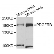 Western blot analysis of extracts of various cell lines, using PDGFRB antibody (abx001792) at 1/1000 dilution.