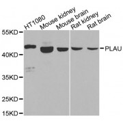 Western blot analysis of extracts of various cell lines, using PLAU antibody (abx001793) at 1/1000 dilution.
