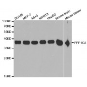 Western blot analysis of extracts of various cell lines, using PPP1CA antibody (abx001796) at 1/1000 dilution.