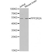 Western blot analysis of extracts of various cell lines, using PPP2R2A antibody (abx001797) at 1/1000 dilution.