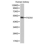 Western blot analysis of extracts of human kidney, using PSEN1 antibody (abx001799).