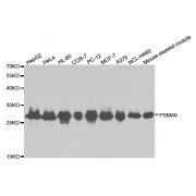 Western blot analysis of extracts of various cell lines, using PSMA6 antibody (abx001800) at 1/1000 dilution.