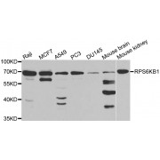 Western blot analysis of extracts of various cell lines, using RPS6KB1 antibody (abx001802) at 1/1000 dilution.