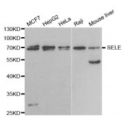 Western blot analysis of extracts of various cell lines, using SELE antibody (abx001803) at 1/1000 dilution.