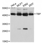 Western blot analysis of extracts of various cell lines, using TBP antibody (abx001804) at 1/1000 dilution.