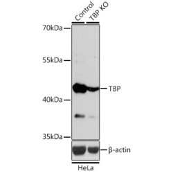 TATA Box Binding Protein (TBP) Antibody