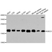 Western blot analysis of extracts of various cell lines, using UBE2I antibody (abx001805) at 1/1000 dilution.