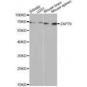 Western blot analysis of extracts of various cell lines, using ZAP70 Antibody (abx001807) at 1/1000 dilution.