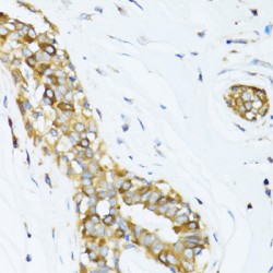 Dynactin Subunit 2 (DCTN2) Antibody