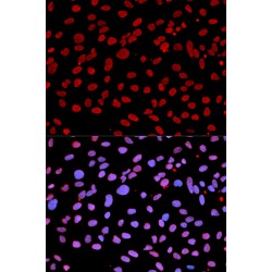 Interferon Induced With Helicase C Domain 1 (IFIH1) Antibody