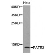 Western blot analysis of extracts of HeLa cells, using PATE3 antibody (abx001816).