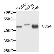 Western blot analysis of extracts of various cell lines, using CD24 antibody (abx001818) at 1/1000 dilution.