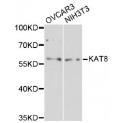 Western blot analysis of extracts of various cell lines, using KAT8 antibody (abx001819) at 1:3000 dilution.