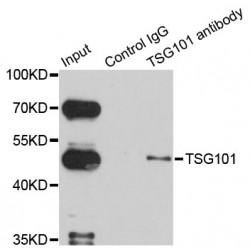 Tumor Susceptibility Gene 101 (TSG101) Antibody