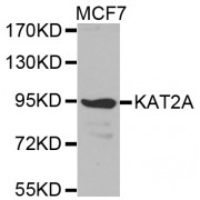 Western blot analysis of extracts of MCF-7 cells, using KAT2A antibody (abx001825).