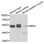 Western blot analysis of extracts of various cell lines, using MBD2 antibody (abx001828) at 1/1000 dilution.