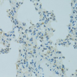 Methyl-CpG Binding Domain Protein 2 (MBD2) Antibody
