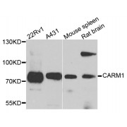 Western blot analysis of extracts of various cell lines, using CARM1 antibody (abx001833) at 1/1000 dilution.