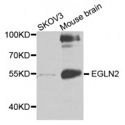 Western blot analysis of extracts of various cell lines, using EGLN2 antibody (abx001837) at 1/1000 dilution.