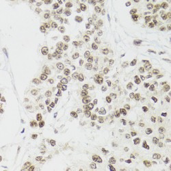 Endothelial Differentiation-Related Factor 1 (EDF1) Antibody