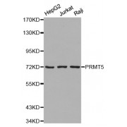 Western blot analysis of extracts of various cell lines, using PRMT5 antibody (abx001862).