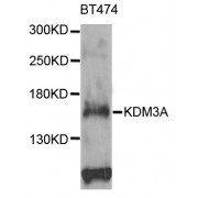 Western blot analysis of extracts of BT-474 cells, using KDM3A antibody (abx001885) at 1/1000 dilution.