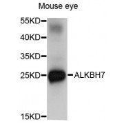 Western blot analysis of extracts of mouse eye, using ALKBH7 antibody (abx001893) at 1/1000 dilution.