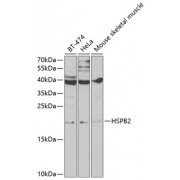 Western blot analysis of extracts of various cell lines, using HSPB2 antibody (abx001907) at 1/1000 dilution.