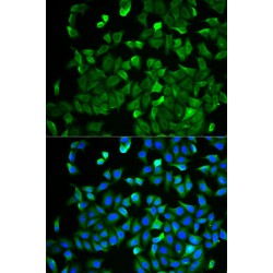 Merlin (NF2) Antibody